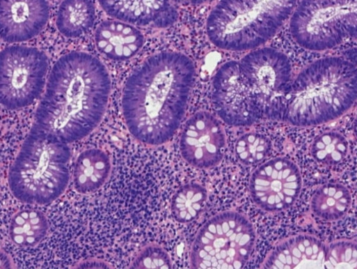 Logopat Grupo Echevarne